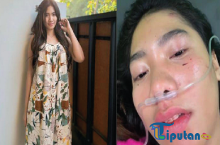 Mengenal Lusyana Jelita: Pedangdut Muda yang Selamat dari Kecelakaan Tragis