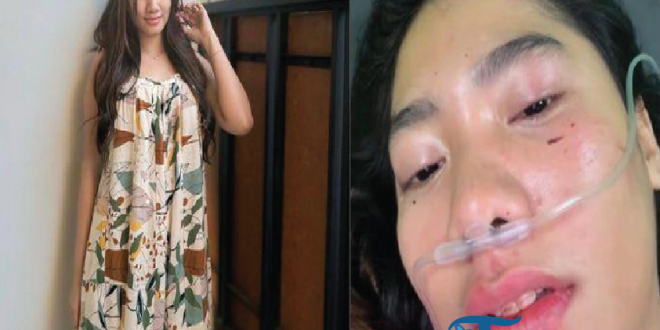 Mengenal Lusyana Jelita: Pedangdut Muda yang Selamat dari Kecelakaan Tragis