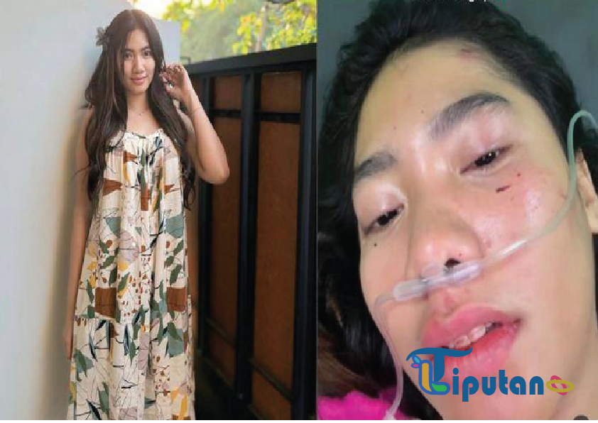 Mengenal Lusyana Jelita: Pedangdut Muda yang Selamat dari Kecelakaan Tragis