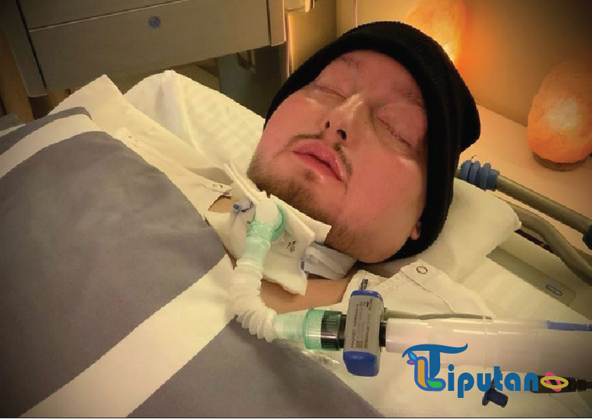 Menguak Misteri Kecelakaan Sang "Pangeran Tidur" Arab Saudi: 20 Tahun dalam Koma