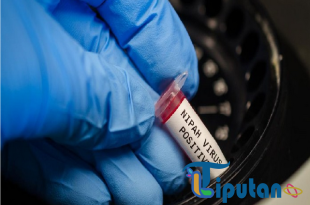 Virus Nipah Muncul di India, Kemenkes Ingatkan Bahaya Gejala dan Jalur Penularan