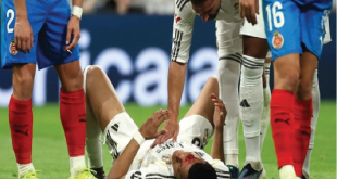 Super League: Wajah Mbappé Berdarah, Madrid Ditahan Girona 1-1