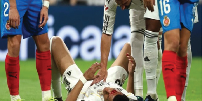 Super League: Wajah Mbappé Berdarah, Madrid Ditahan Girona 1-1