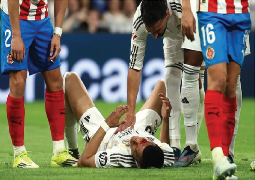 Super League: Wajah Mbappé Berdarah, Madrid Ditahan Girona 1-1